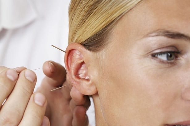 Woman with acupuncture needles in ear